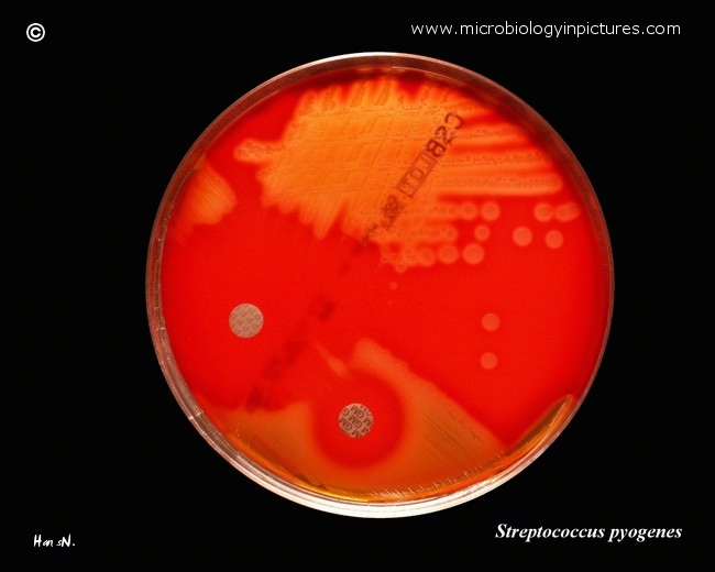 streptococcus-pyogenes-growing-on-blood-agar-susceptibility-to-penicillin